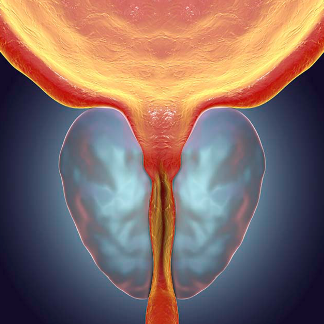 Prostatite
