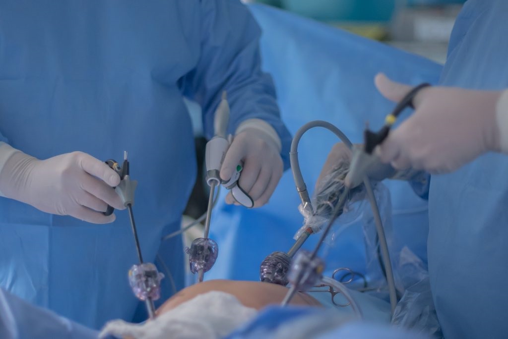 cirurgia-laparoscopica.jpg