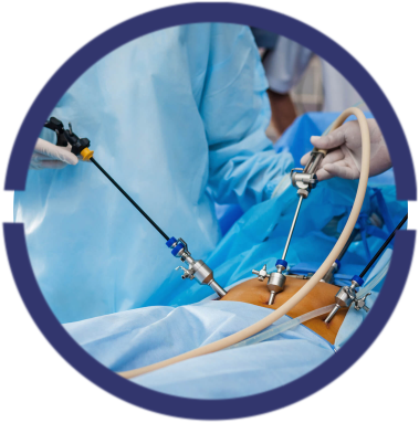 cirurgia-laparoscopica.png