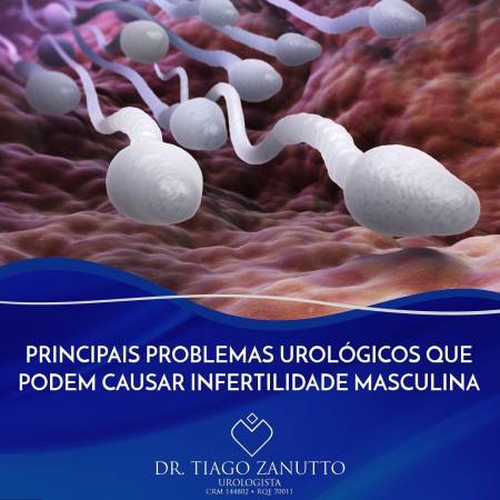 Infertilidade masculina