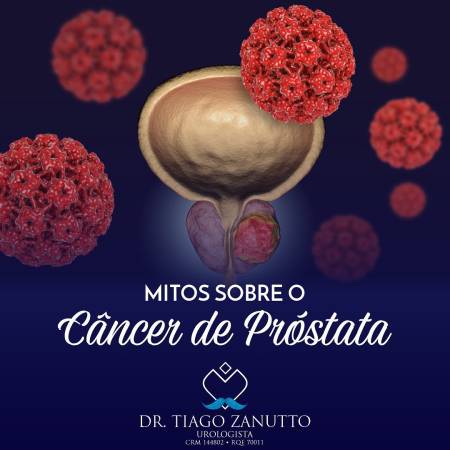 Mitos câncer de próstata