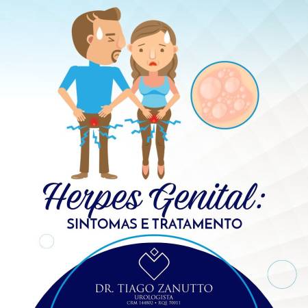 Herpes genital 