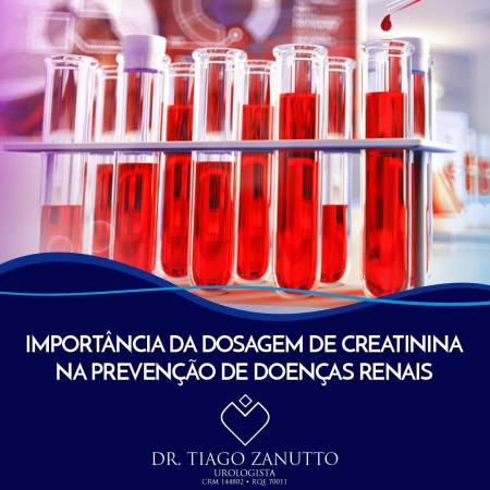 Dosagem da creatinina