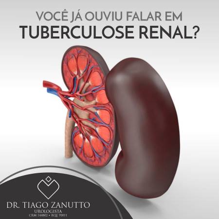 Tuberculose renal 
