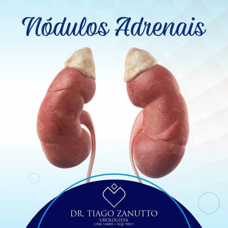 Nódulos adrenais