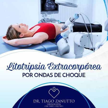 Litotripsia extracorpórea