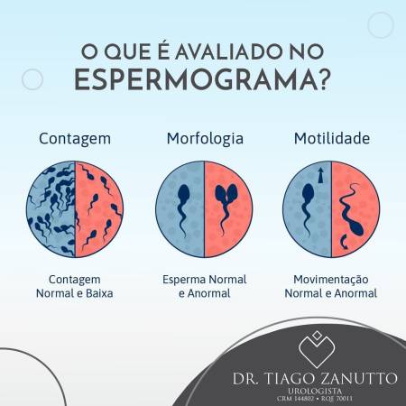 Espermograma