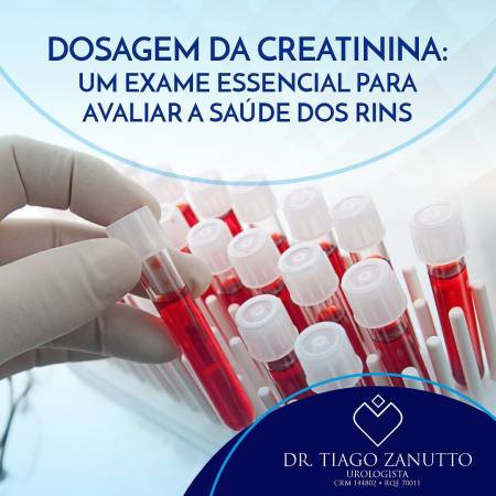 Creatinina
